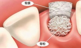 佛山种牙爆料事件视频,揭露行业乱象，患者权益谁来守护？